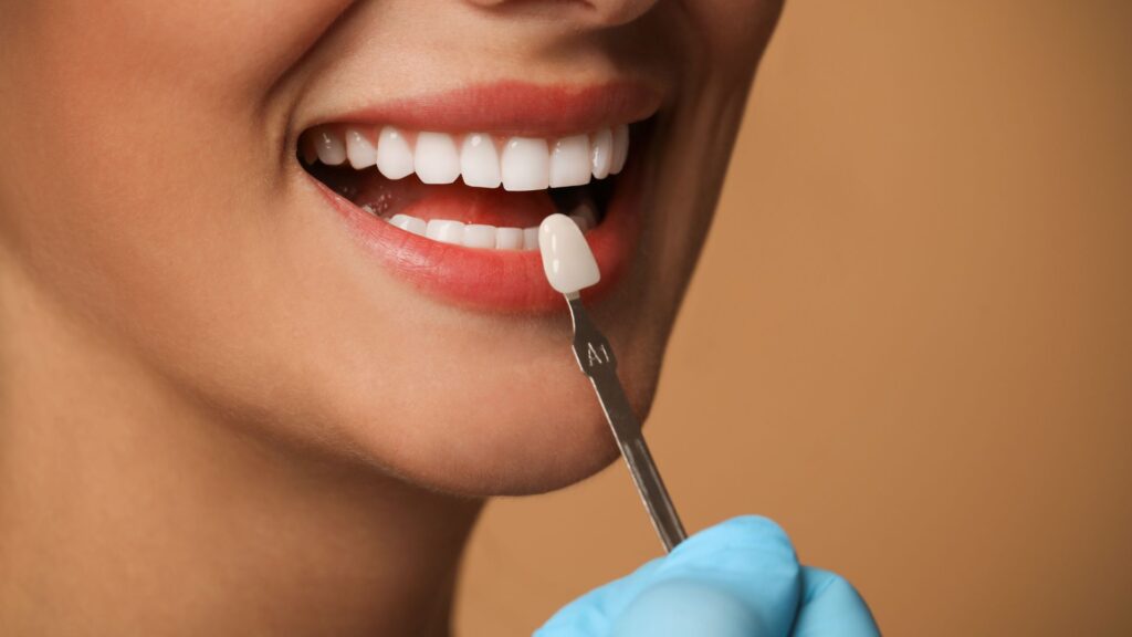 Saiba onde fazer facetas de porcelana em São José do Rio Preto. Descubra a qualidade e experiência da Essence Odontologia.