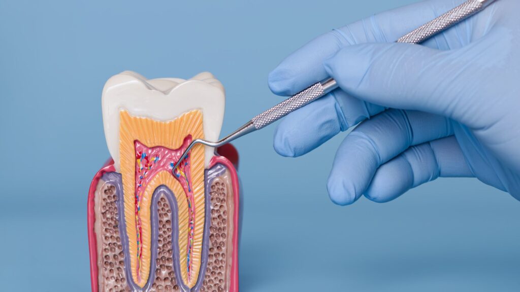 Descubra onde fazer periodontia em São José do Rio Preto e cuide da sua saúde bucal com profissionais qualificados na Essence Odontologia.